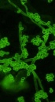 <i>In Vitro</i> Antidrug Susceptibility Testing of <i>Candida</i> Species Isolated from Aseptic Body Fluids